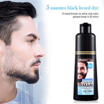 The man has a mustache, needs hair washing, and is experiencing hair loss.